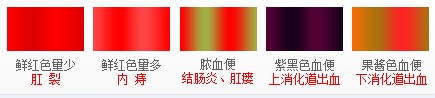 Ѫʲôԭ