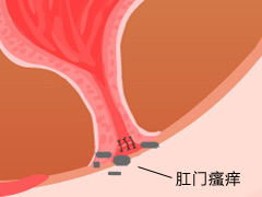 女性肛门瘙痒的原因是什么？
