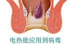 pph