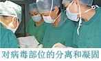 hcpt